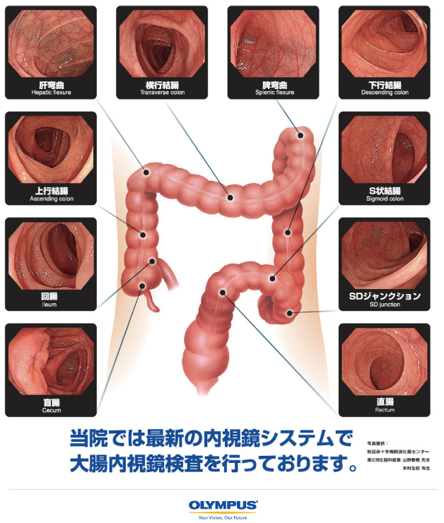 胃カメラ（胃内視鏡検査）・大腸カメラ（大腸内視鏡検査）｜茅ヶ崎市｜茅ヶ崎クリニック